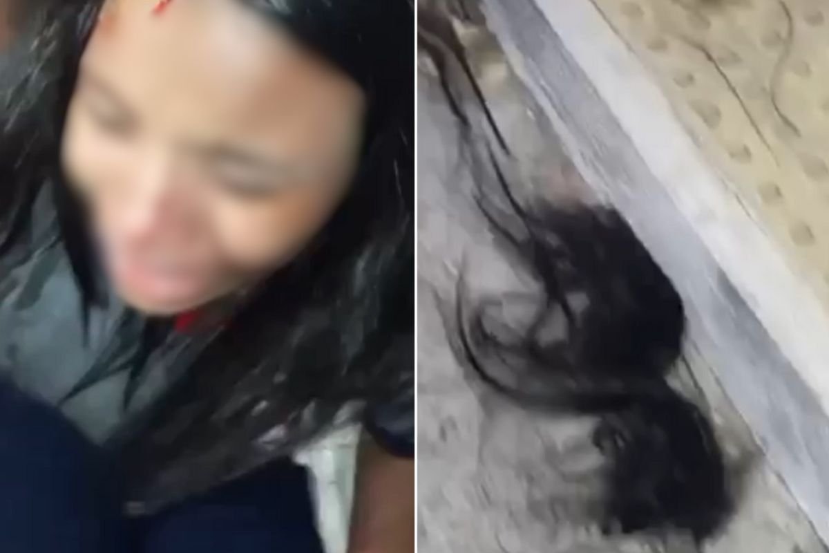 Jovem é agredida com tesoura em Caicó, na zona leste, após sair da escola. Polícia investiga possível tentativa de homicídio por ciúmes.