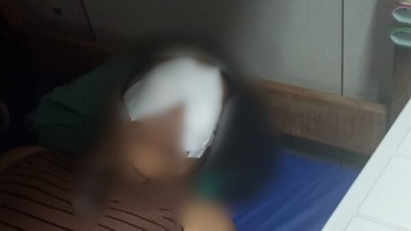 Servidora do Hospital Walfredo Gurgel é atingida por vapores de desinfetante; SESAP e hospital garantem acompanhamento e suspensão do produto.