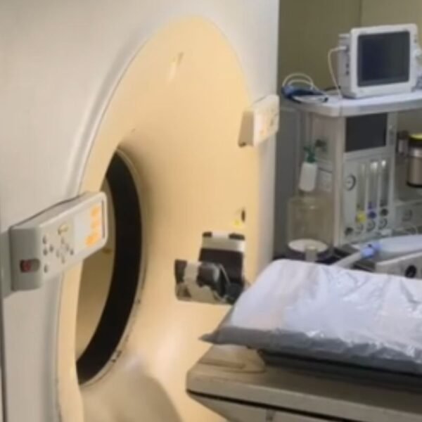 Tomógrafo do Hospital Walfredo Gurgel está sem funcionar desde o fim de semana após falhas causadas por quedas de energia. Equipamento deve voltar na sexta.