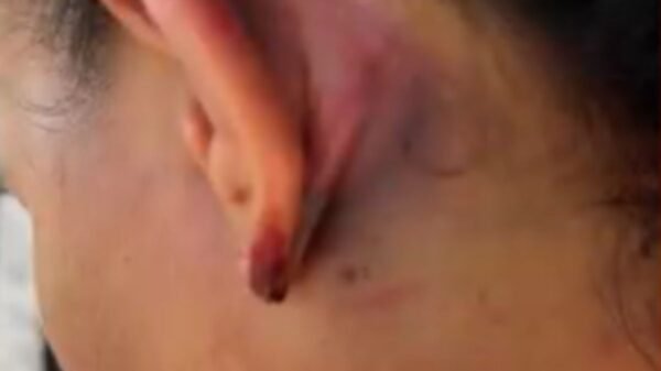 Advogada relata agressões sofridas por PMs em Serra do Mel. OAB aprova desagravo público e 10 policiais são afastados enquanto o caso é investigado.