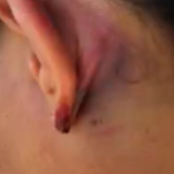 Advogada relata agressões sofridas por PMs em Serra do Mel. OAB aprova desagravo público e 10 policiais são afastados enquanto o caso é investigado.