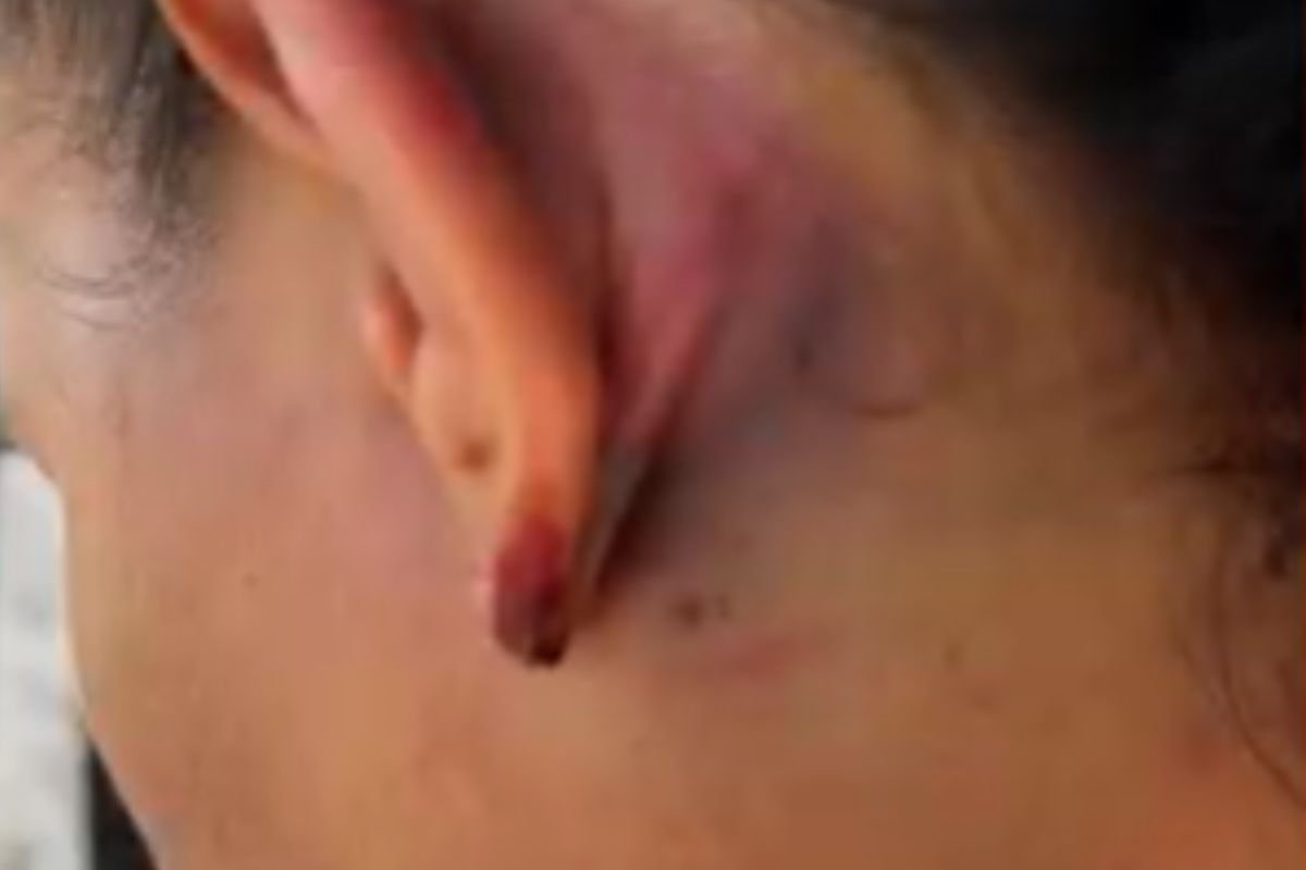 Advogada relata agressões sofridas por PMs em Serra do Mel. OAB aprova desagravo público e 10 policiais são afastados enquanto o caso é investigado.