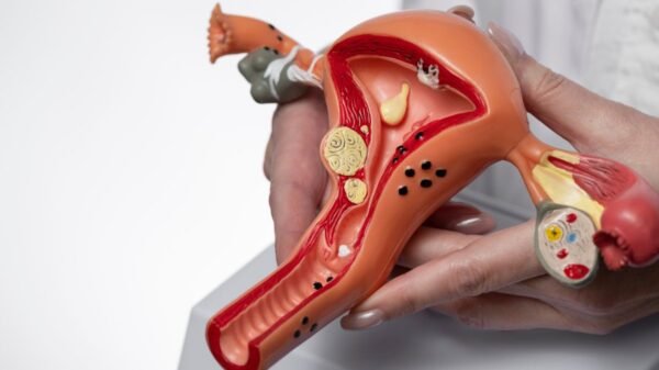 RN cria cadastro estadual para mapear casos de endometriose e orientar políticas públicas de saúde voltadas às pessoas diagnosticadas com a doença.