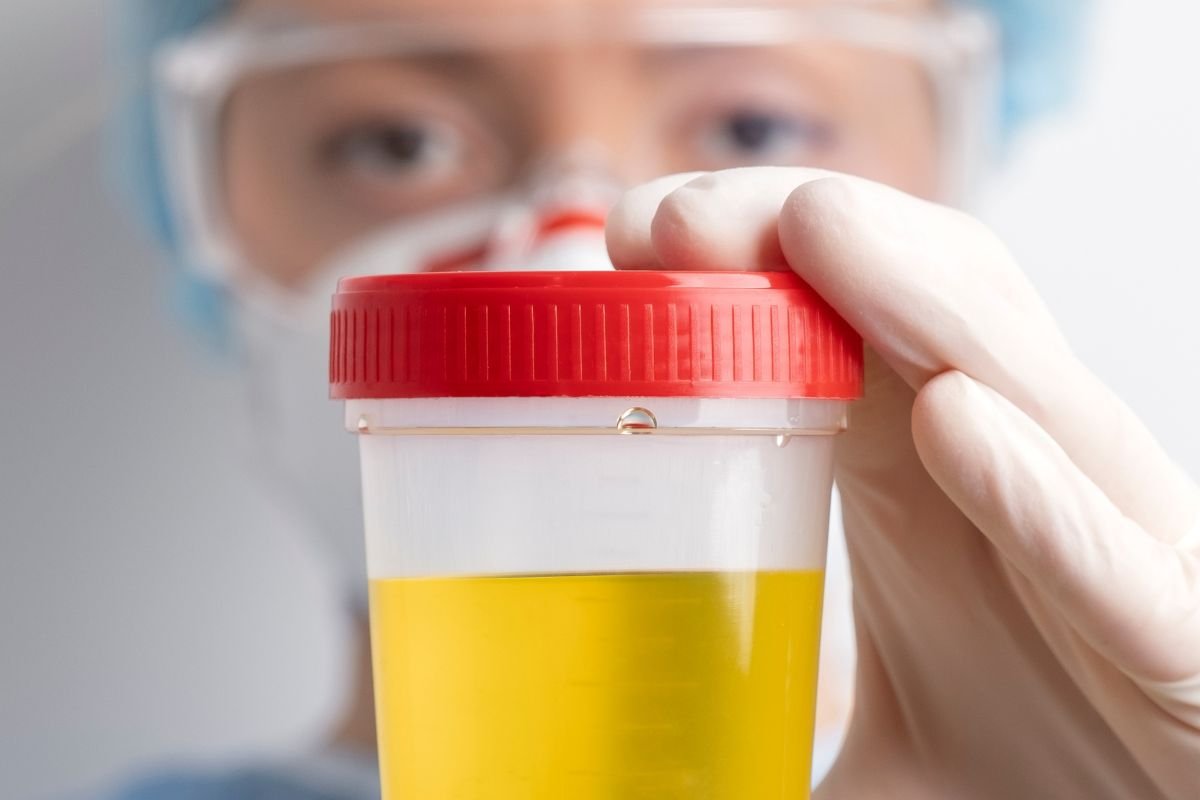 Médico de laboratório realizando exame médico de urina