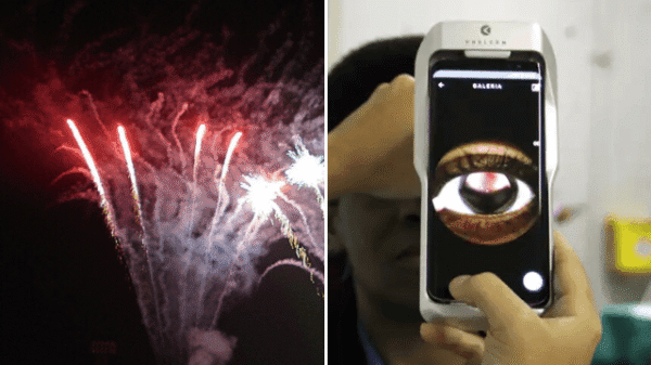 Fogos de artifício no Ano-Novo representam riscos de acidentes e lesões oculares