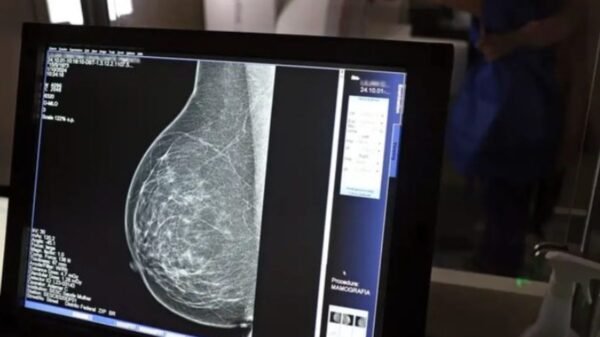 Mamografia no SUS passa a ser garantida para mulheres a partir dos 40 anos após sanção da Lei nº 15.284, publicada no Diário Oficial da União.