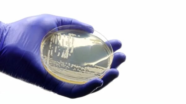 Sesap confirma caso do fungo Candida auris em paciente internado no Hospital Walfredo Gurgel, em Natal. Homem está isolado e em monitoramento.