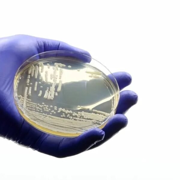 Hospital da Polícia Militar no RN monitora dois pacientes colonizados pelo fungo Candida auris e reforça protocolos de segurança e controle epidemiológico.