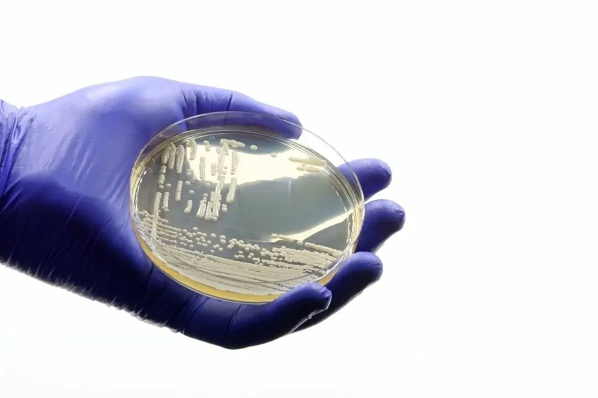 Sesap confirma caso do fungo Candida auris em paciente internado no Hospital Walfredo Gurgel, em Natal. Homem está isolado e em monitoramento.