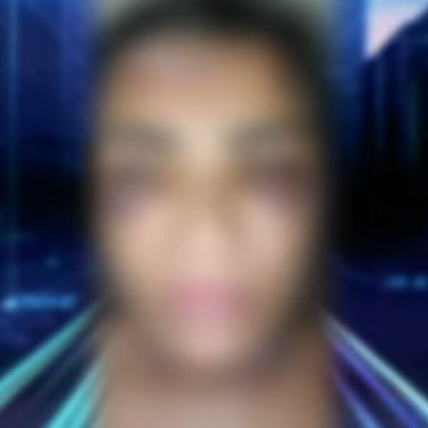 Estupro em Guamaré: mulher é abusada sexualmente por dois primos após discussão em confraternização familiar no interior do RN.